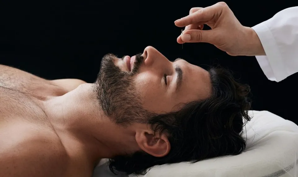 Acupuncteur : définition, rôle et bienfaits de l'acupuncture